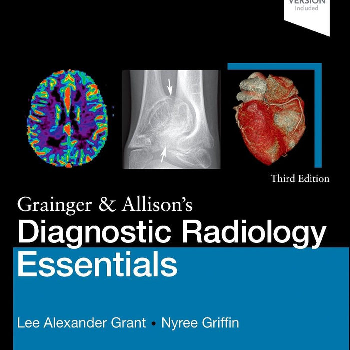 Grainger & Allison's Diagnostic Radiology Essentials Grainger & Allison's Diagnostic Radiology Essentials
