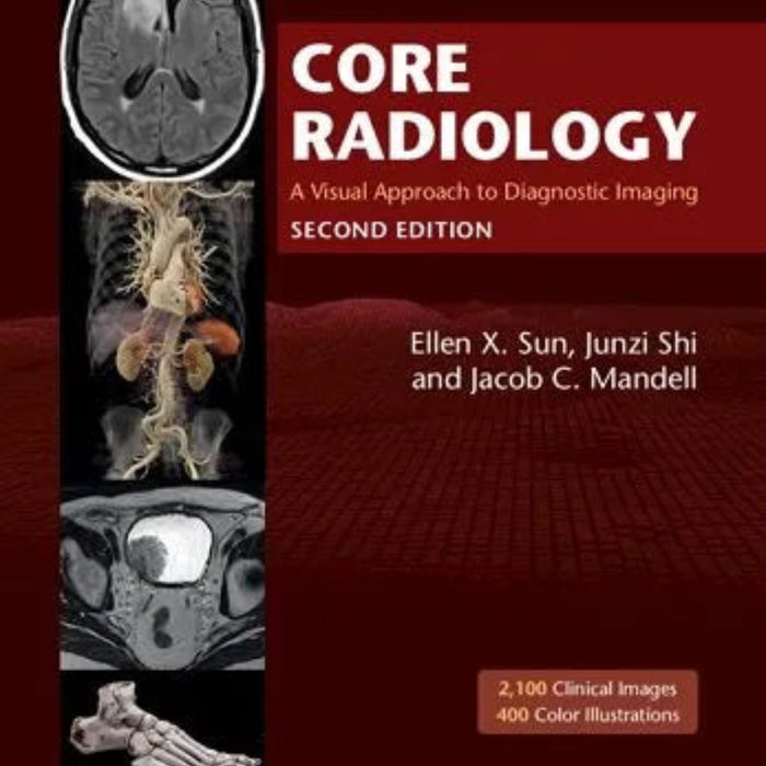 Core Radiology: A Visual Approach to Diagnostic Imaging Core Radiology: A Visual Approach to Diagnostic Imaging