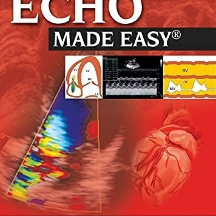 Echo Made Easy Echo Made Easy