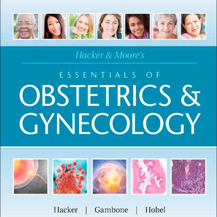 Hacker & Moore's Essentials of Obstetrics and Gynecology 6th Edition by Neville F. Hacker MD (Author), Joseph C. Gambone DO MPH Executive Editor (Author), Calvin J. Hobel MD (Author)