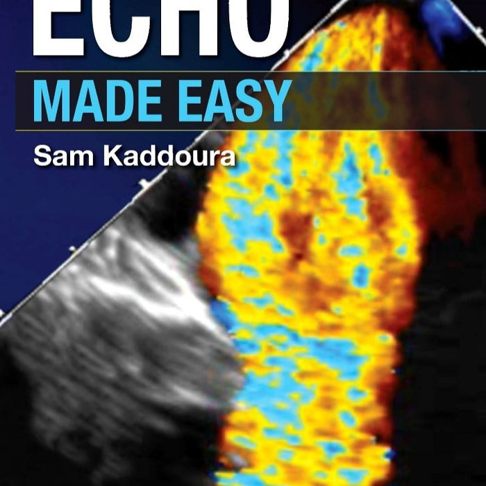 Echo Made Easy 3rd Eition By Sam Kaddoura