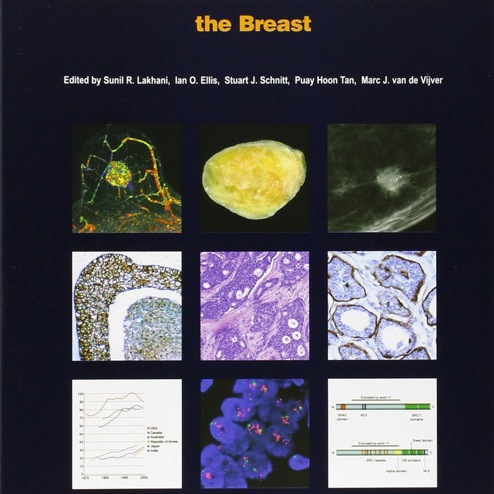  WHO classification of tumours of the breast (World Health Organization Classification of Tumours)