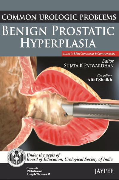 Common Urologic Problems Benign Prostatic Hyperplasia By Sujata Patwardhan