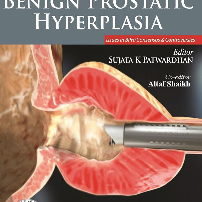 Common Urologic Problems Benign Prostatic Hyperplasia By Sujata Patwardhan