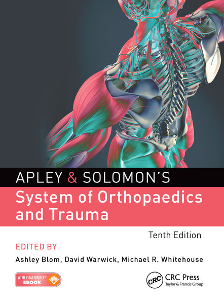 Apley And Solomon's Concise System of Orthopaedics and Trauma For DPT