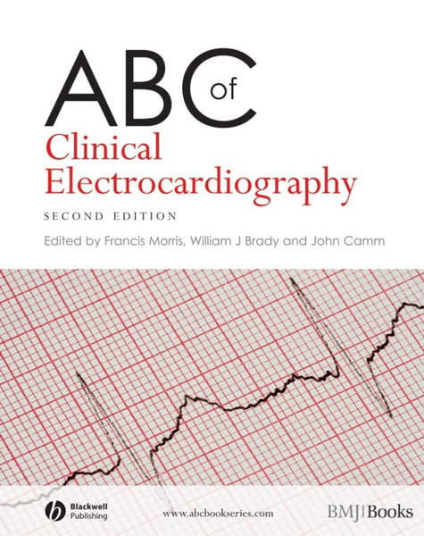 ABC Of Clinical Electrocardiography