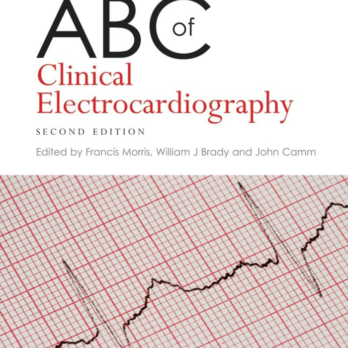 ABC Of Clinical Electrocardiography