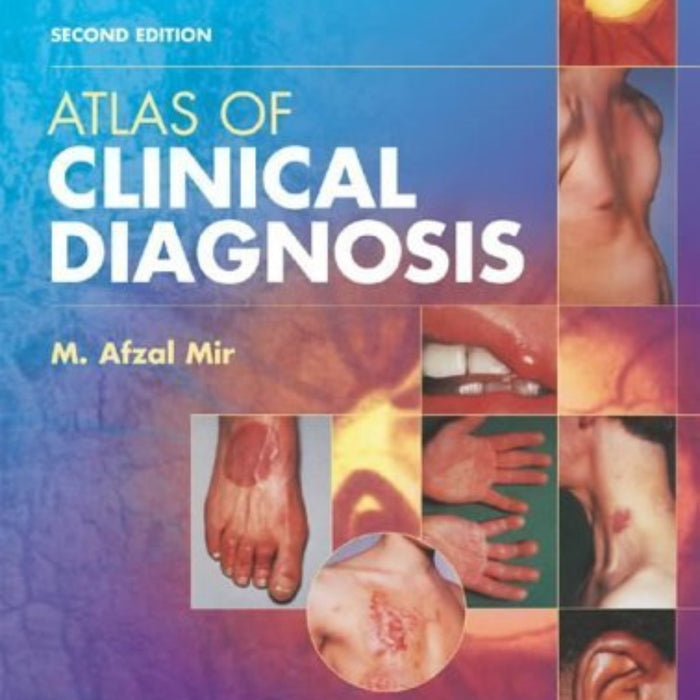 Atlas of Clinical Diagnosis 2nd Edition