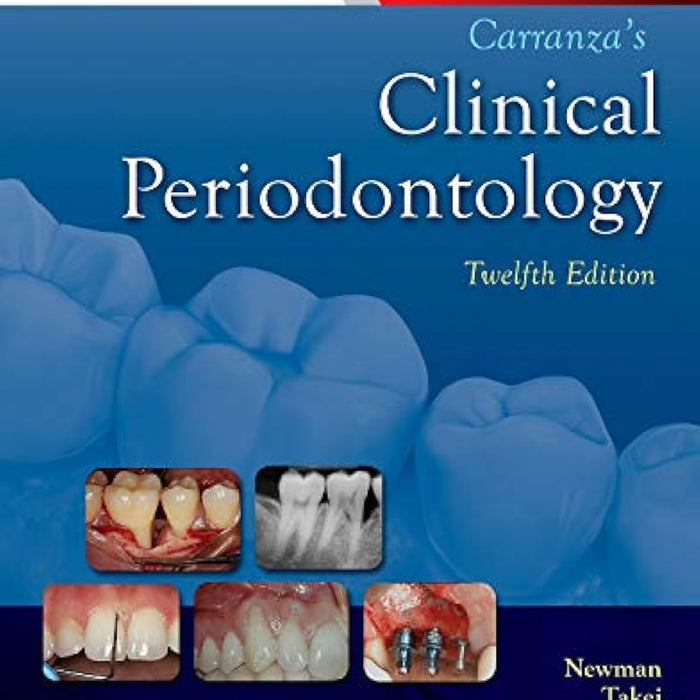 Carranza's Clinical Periodontology