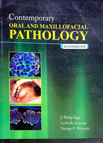 Contemporary Oral And Maxillofacial Pathology