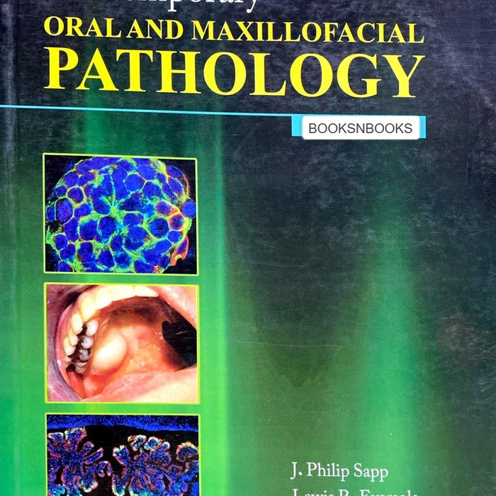 Contemporary Oral And Maxillofacial Pathology