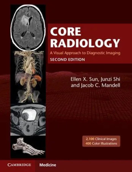 Core Radiology: A Visual Approach to Diagnostic Imaging