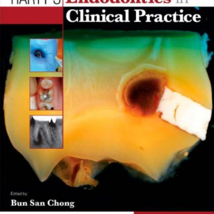 Harty's Endodontics in Clinical Practice