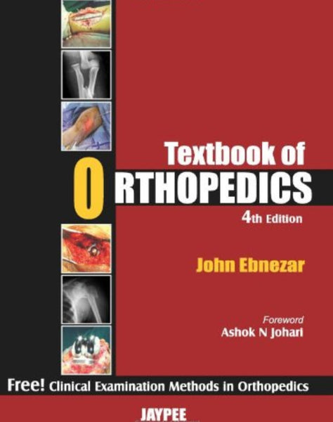 Textbook of Orthopedics 