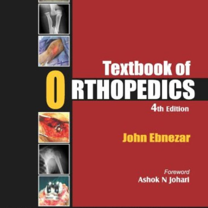 Textbook of Orthopedics 