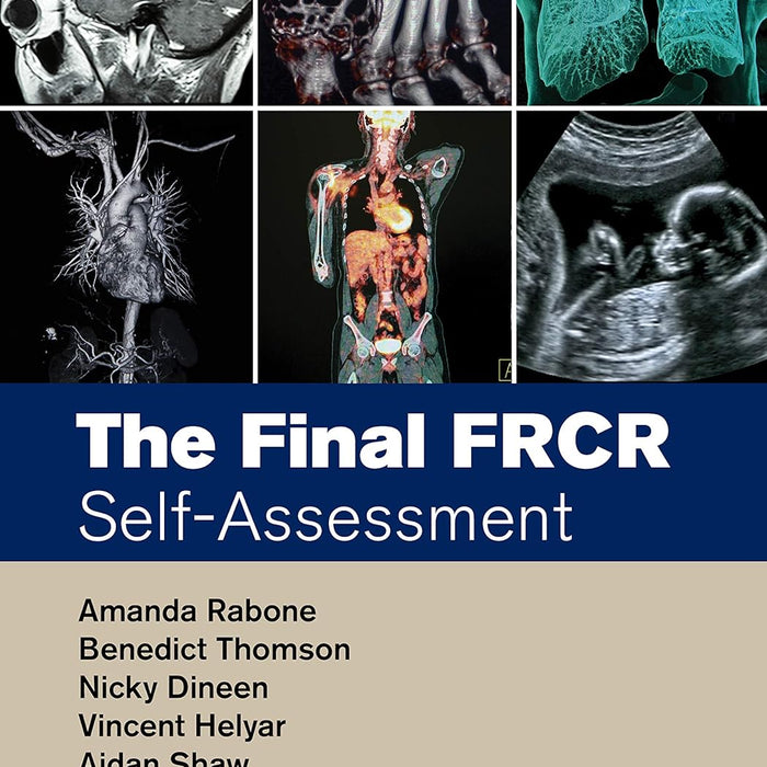 The Final FRCR Self Assessment