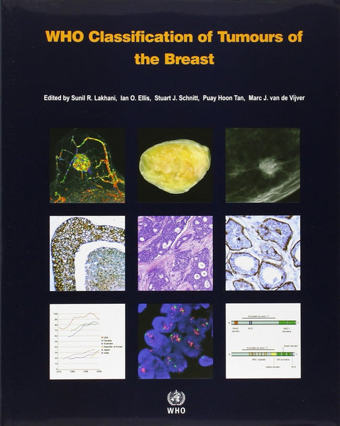  WHO classification of tumours of the breast (World Health Organization Classification of Tumours)