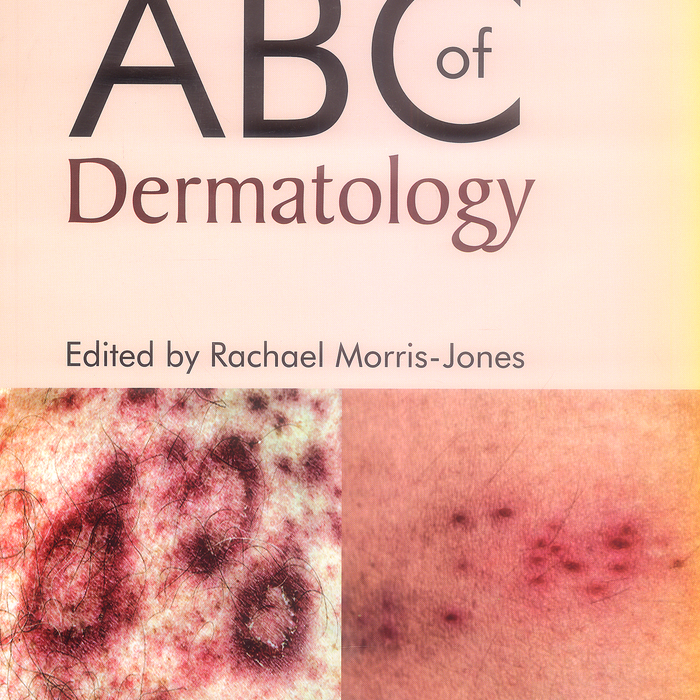 ABC Of Dermatology 7th Edition By Rachael Morris Jones