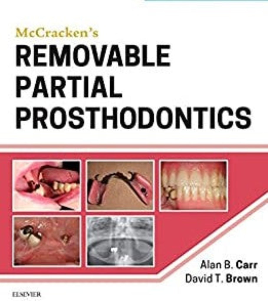 Mccrackens Removable Partial Prosthodontics by Alan B. Carr (Author ...