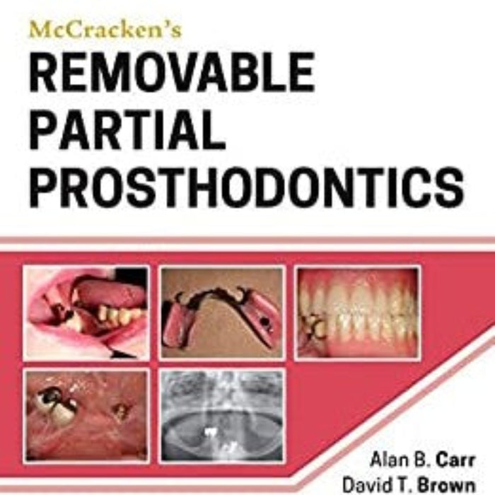 Mccrackens Removable Partial Prosthodontics