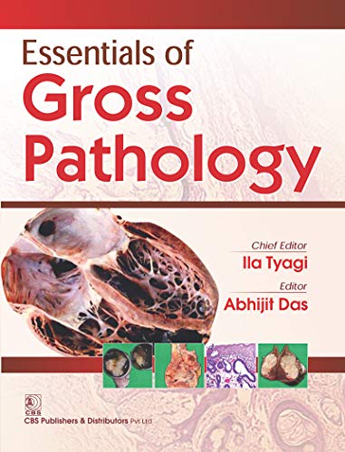 Essentials Of Gross Pathology By Ila Tyagi