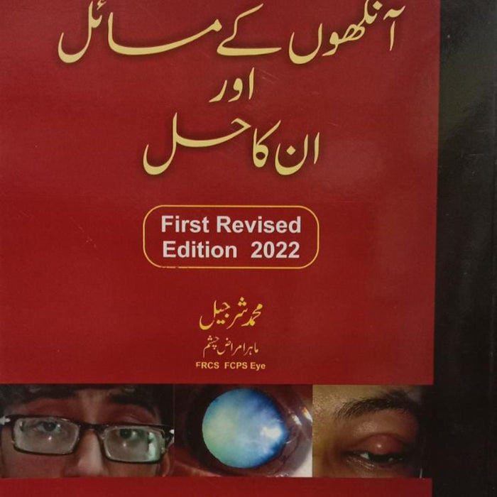 Ankhoon Kay Masail Aur Unka Hal - آنکھوں کے مسائل  اور  ان کا حل 