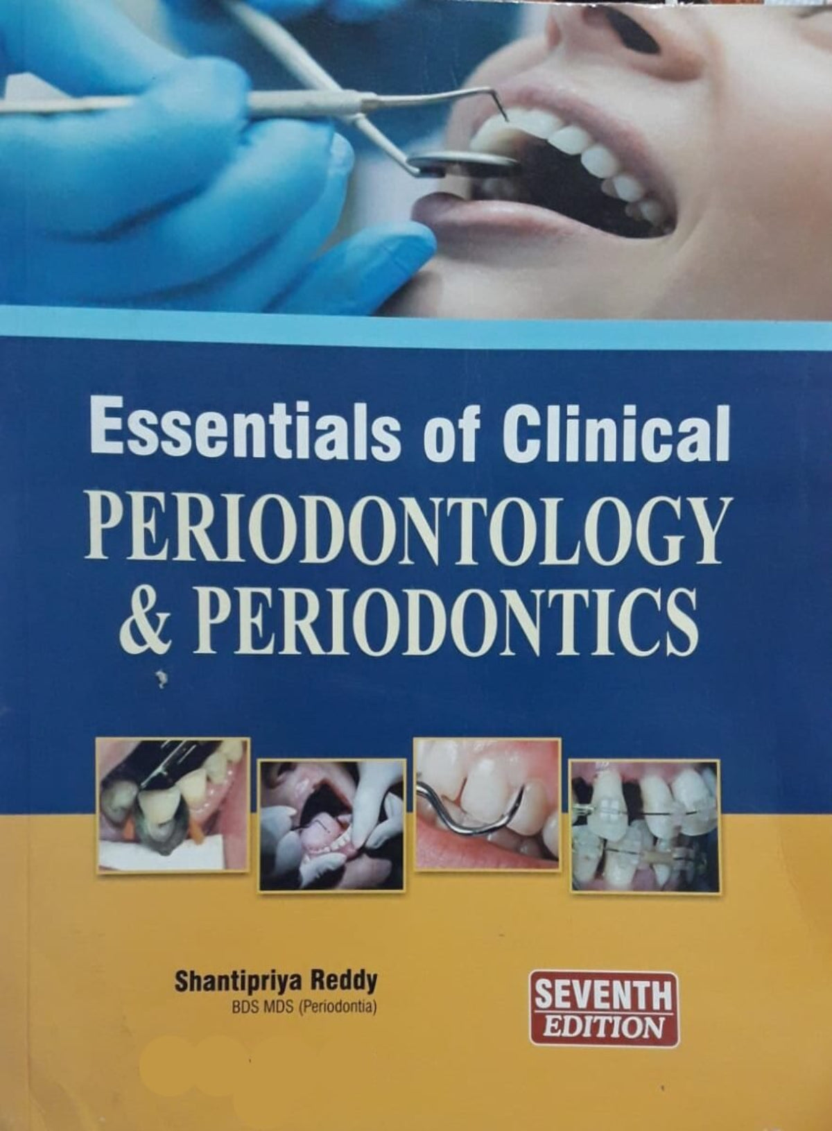 Essentials Of Clinical Periodontology And Periodontics by Shantipriya ...