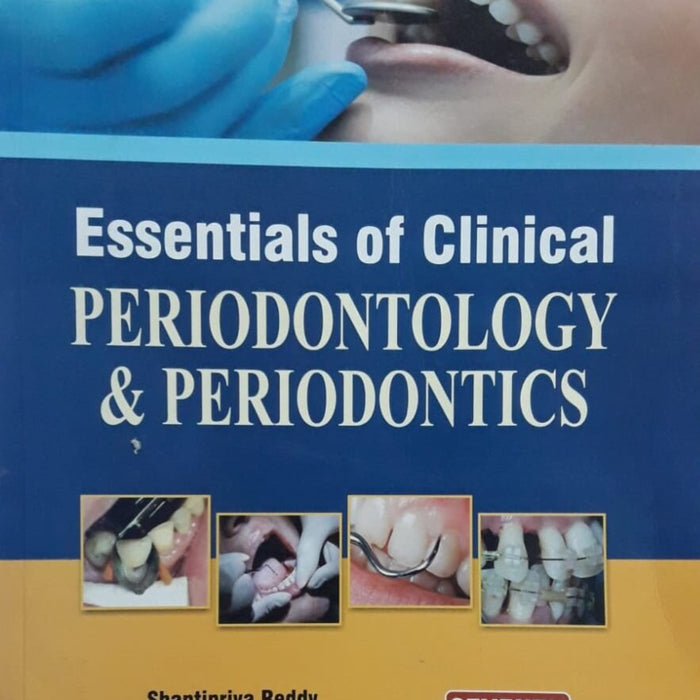 Essentials Of Clinical Periodontology And Periodontics