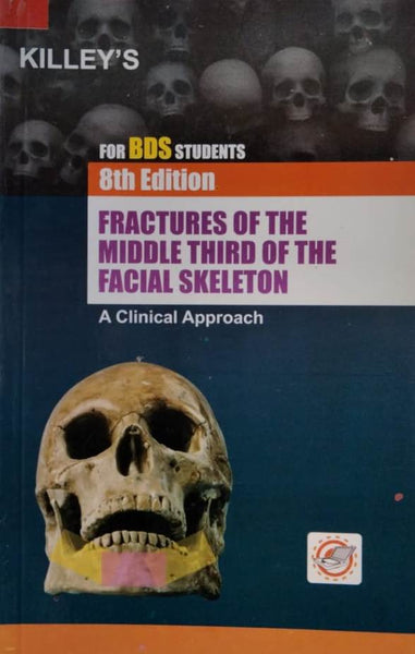 Killeys Fractures Of The Middle Third Of The Facial Skeleton