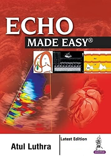 Echo Made Easy